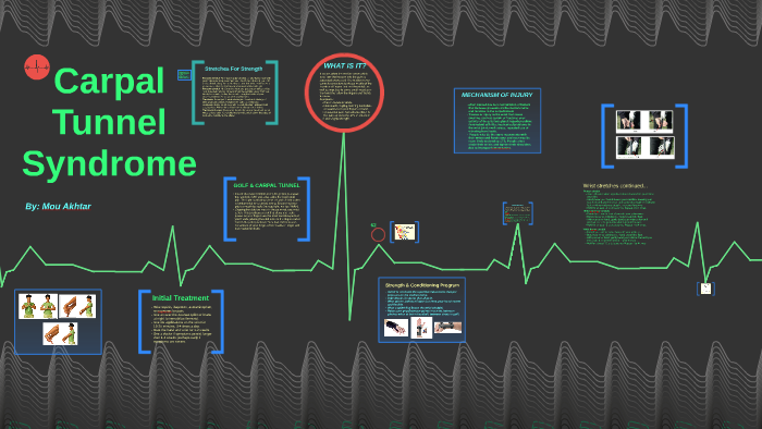 case presentation carpal tunnel syndrome