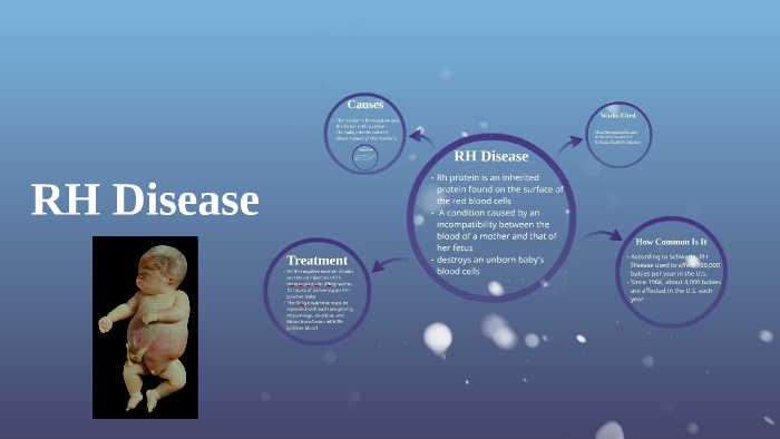 RH Disease By Lacey Smith On Prezi