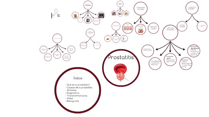 ¿La prostatitis causa dolor rectal? ¿La prostatitis causa dolor rectal?