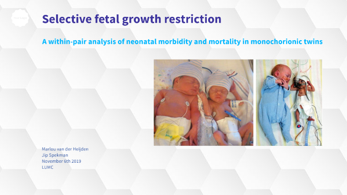 Selective fetal growth restriction by Jip Anne on Prezi
