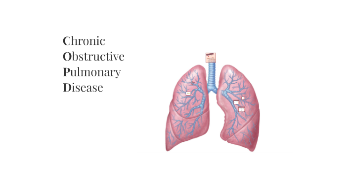 COPD by Nicole Madden on Prezi