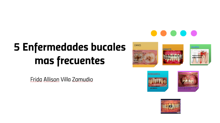 5 Enfermedades Bucales Mas Frecuentes By Allison Villa Zamudio 6033
