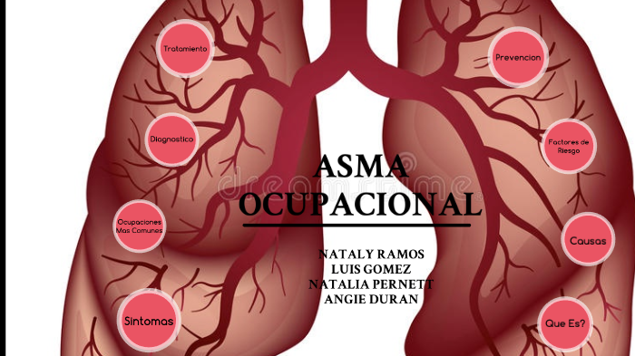 Asma Ocupacional By Nataly Ramos On Prezi 9181