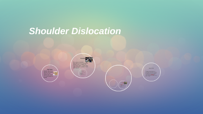 Shoulder Dislocation by Sebastian Razo on Prezi