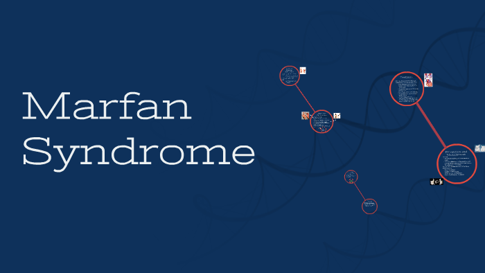 Marfan Syndrome Presentation by Kess Halpin on Prezi