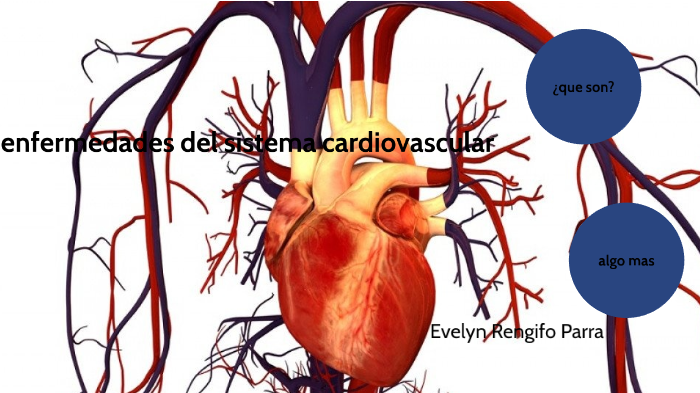 Enfermedades Del Sistema Cardiovascular By Evelyn Reno Parra