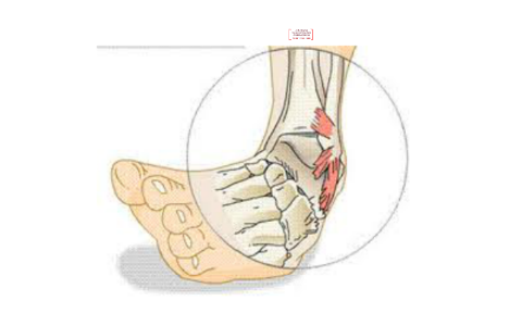 Copy Of Kinesiology Biomechanical Final Project - Ankle Braces By Dean ...