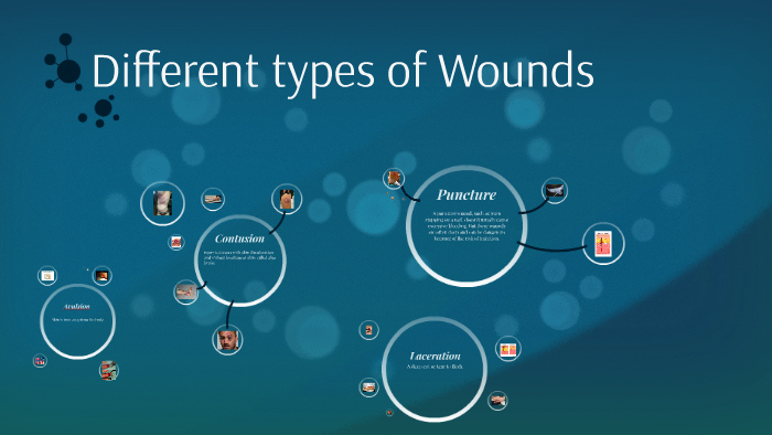 Different typpes of Wounds by Jeremy Roberts on Prezi