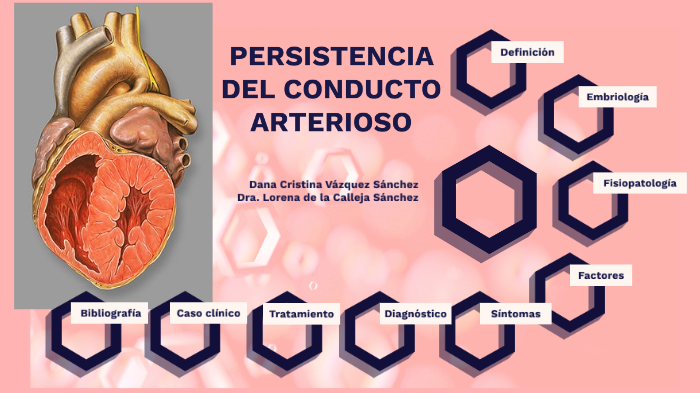 Persistencia del conducto arterioso by Dana Cristina Vázquez Sánchez on ...