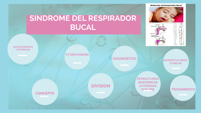 SÍNDROME DEL RESPIRADOR BUCAL by Jessica Bravo on Prezi