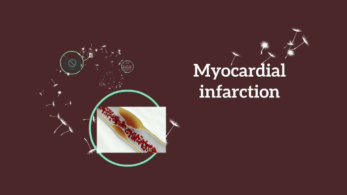 Myocardial infarction by Danequa Smith on Prezi