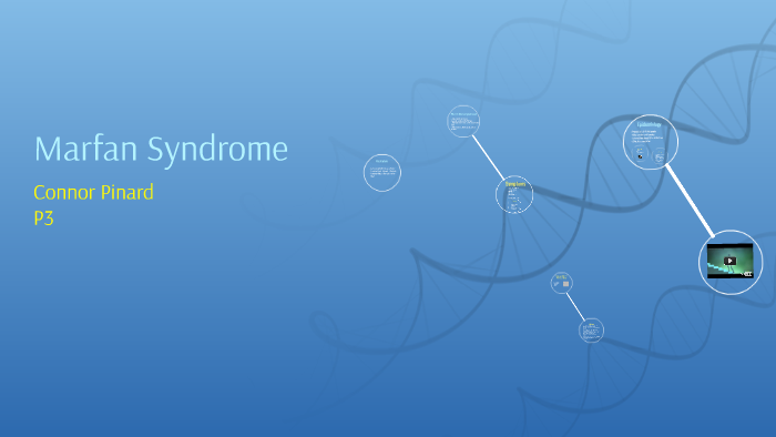 Marfan Syndrome by Cornelius Foffy on Prezi