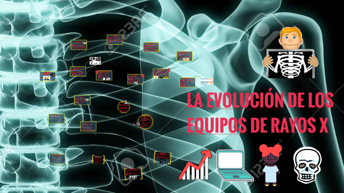 LA EVOLUCIÓN DE LOS EQUIPOS DE RAYOS X by Monica Gonzalez Perez on Prezi