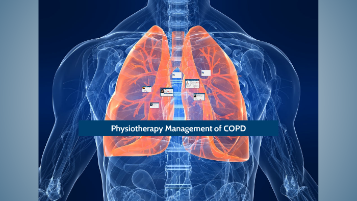 Physiotherapy Management Of Copd By Miles Standen