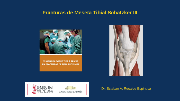 anatomía de la meseta tibial