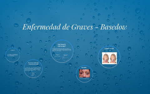 Grace Basedow Enfermedad de Graves - Basedow by Sergio Delgado Reyes on Prezi