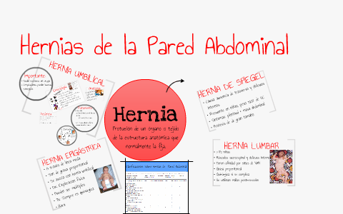Hernias umbilicales y otras hernias de pared abdominal by Abraham ...