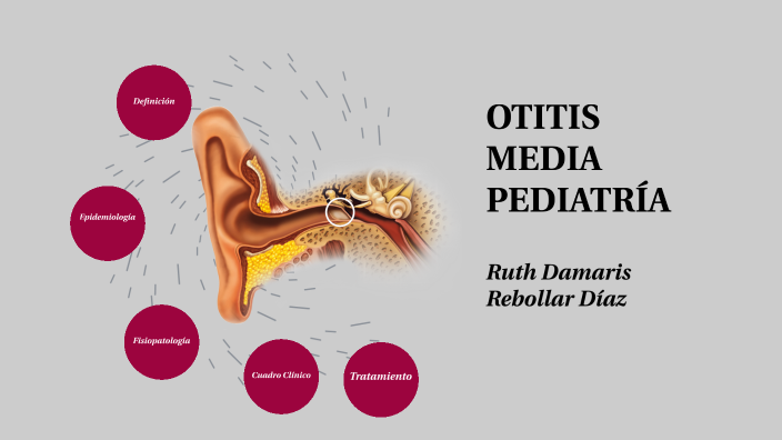 Otitis Media By Ruth Damaris