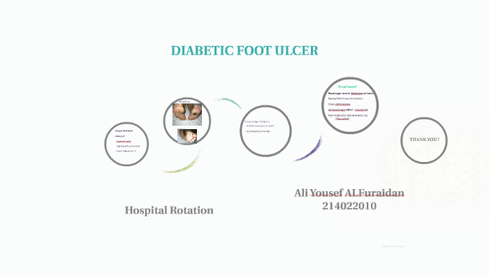 thesis topics on diabetic foot ulcer