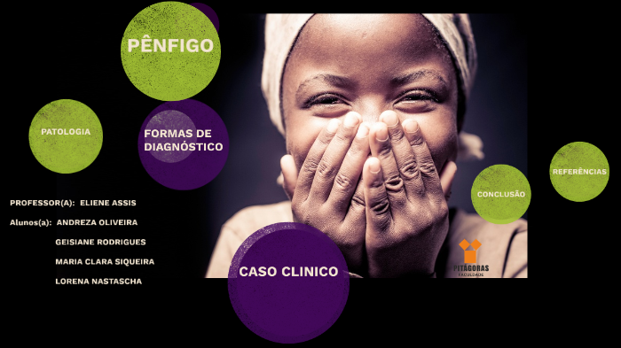 penfigo vulgar caso clinico de diabetes