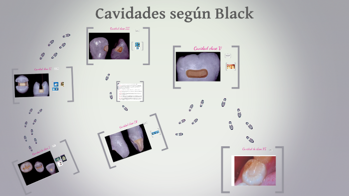 cavidades black by MARVIN GUTIERREZ on Prezi