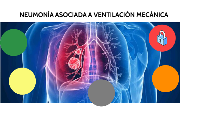 NEUMONIA ASOCIADA A VENTILACIÓN MECÁNICA By Stephany Jassmin Loeza ...