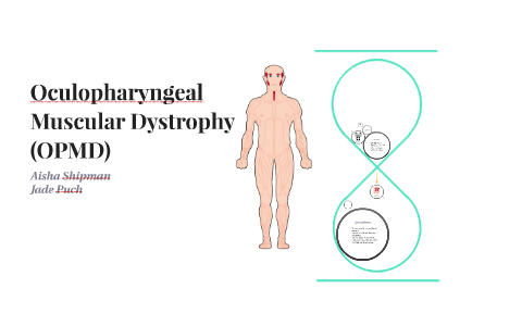 Featured image of post View 23 Oculopharyngeal Muscular Dystrophy Symptoms