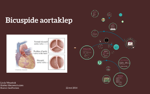 Bicuspide aortaklep by Sharon Geefhuizen on Prezi