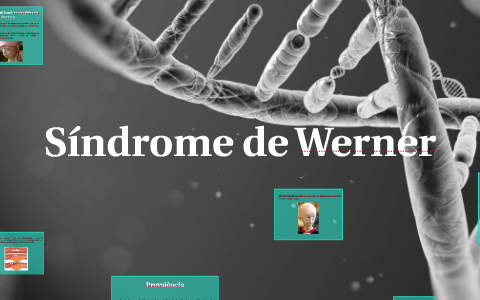 Síndrome de Werner by Inês Tomé on Prezi