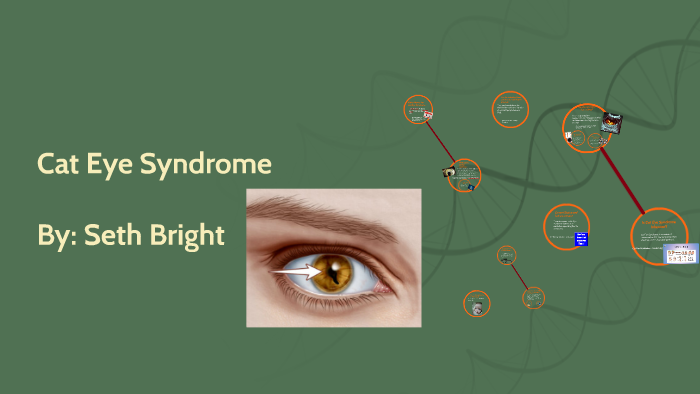 Cat Eye Syndrome By Seth Bright 6671