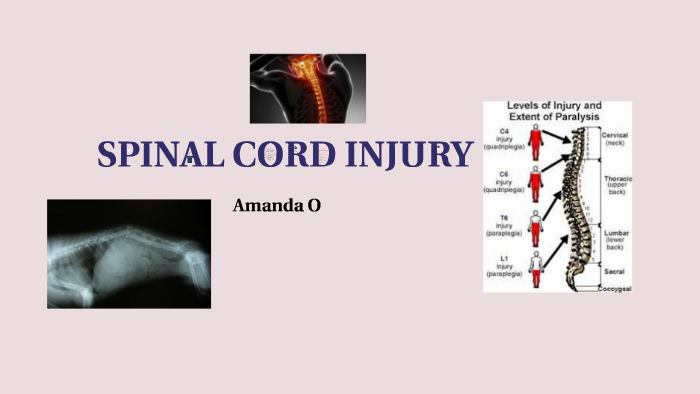 SPINAL CORD INJURY by amanda oxendine on Prezi