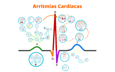 Arritmias Cardíacas by Laura Jimenez on Prezi