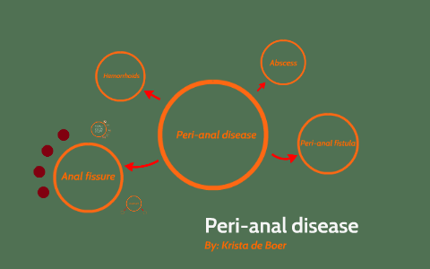 Peri-anal disease by Krista de Boer on Prezi
