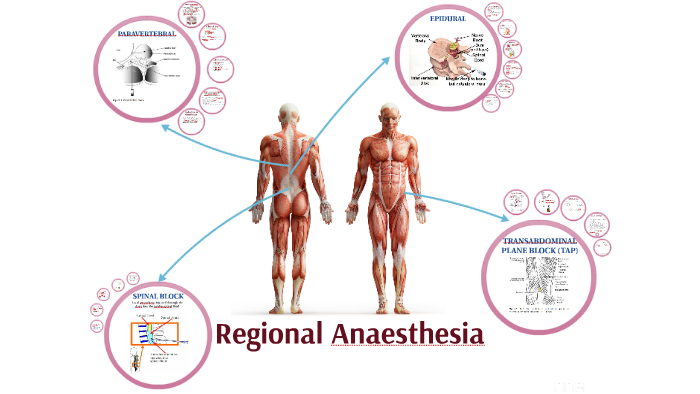 Regional Anaesthesia Overview By Sean Oberholzer On Prezi