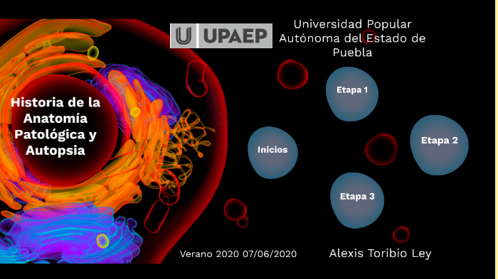 Historia De La Anatomía Patológica By ALEXIS TORIBIO On Prezi