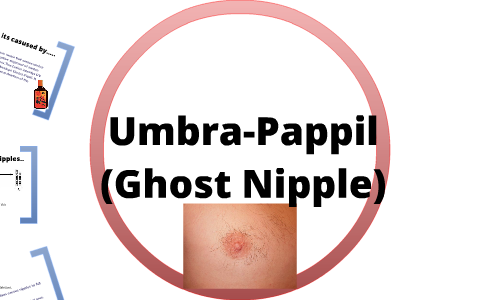 Umbra-Papill (Ghost nipple) by Fernando Gillballs on Prezi