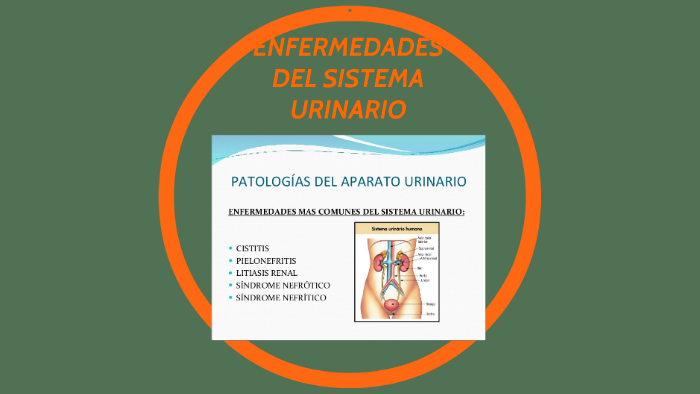 Enfermedades Del Sistema Urinario By Antonio Florentino Rojas Yupanqui 4755
