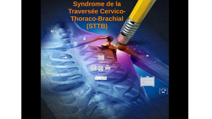 Comment Reeduquer Le Syndrome Du Défilé Thoraco Brachial