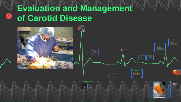 Evaluation and Management of Carotid Disease by scott Reid