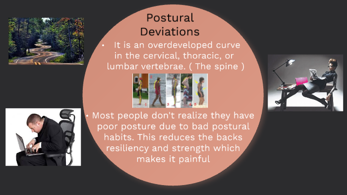 Postural Deviations by Jasmine Gonzalez