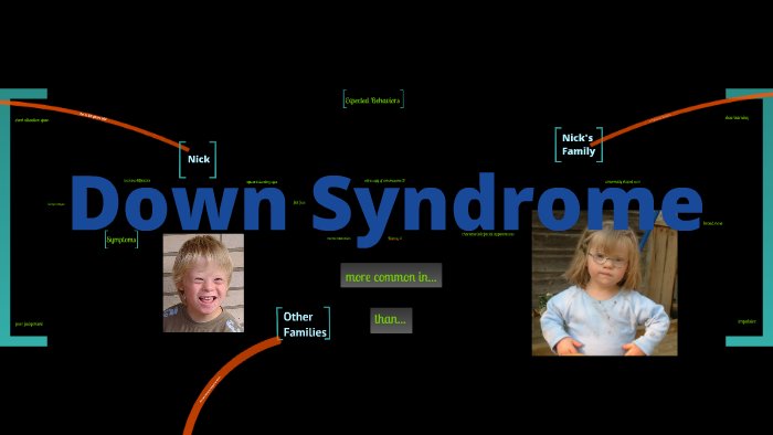 Down Syndrome by Savannah Hague