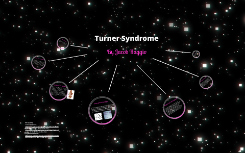 Jacob Raggio turner syndrome by Jacob Raggio on Prezi