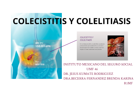 COLECISTITIS Y COLELITIASIS By Brenda Karina Fernandez On Prezi