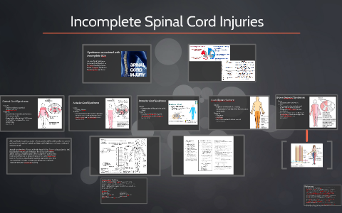 Incomplete Spinal Cord Injuries by carrie Bowers on Prezi