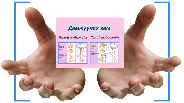 Ерөнхий мэдрэхүйн өөрчлөлт by Ундка Энх-Ундрал on Prezi