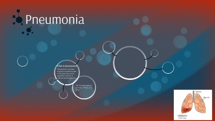 diagnosis-and-management-of-hypersensitivity-pneumonitis-chest-guidelines