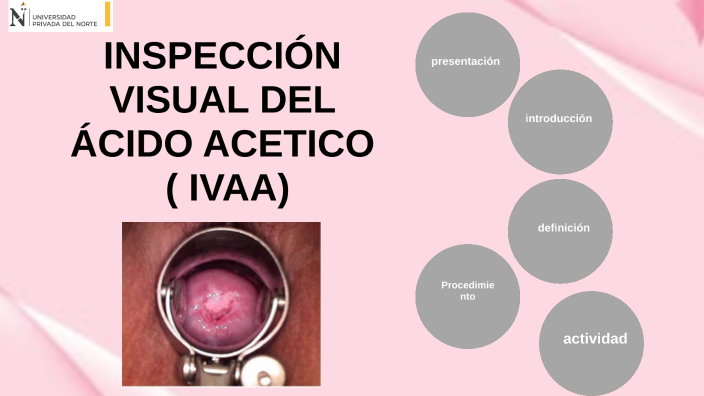 inspecci-n-visual-del-cido-ac-tico-by-jahaira-ayala-inga-on-prezi