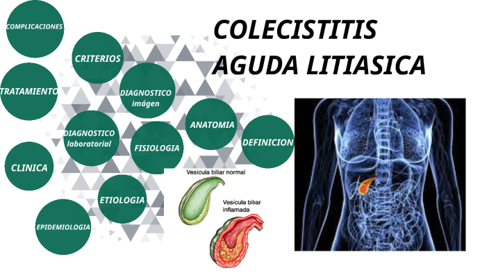 COLECISTITIS AGUDA LITIASICA by Gibelli Celina Quispe on Prezi