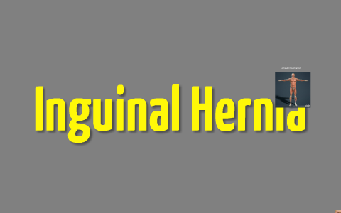 Inguinal Hernias by Kautilya Shaurya on Prezi