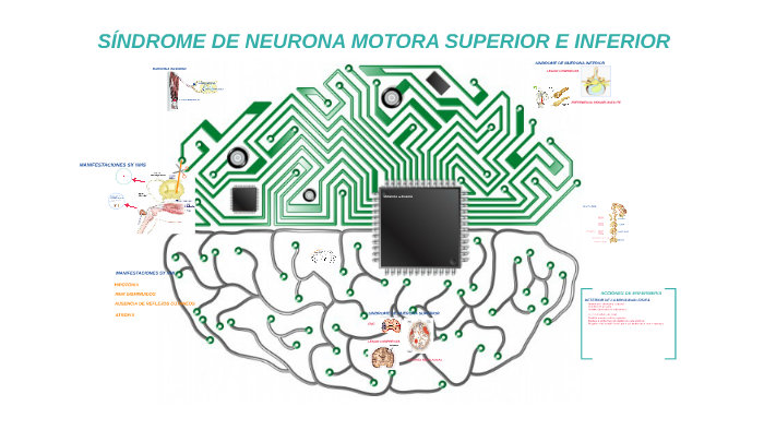 SÍNDROME DE NEURONA MOTORA SUPERIOR E INFERIOR by jose de jesus miranda